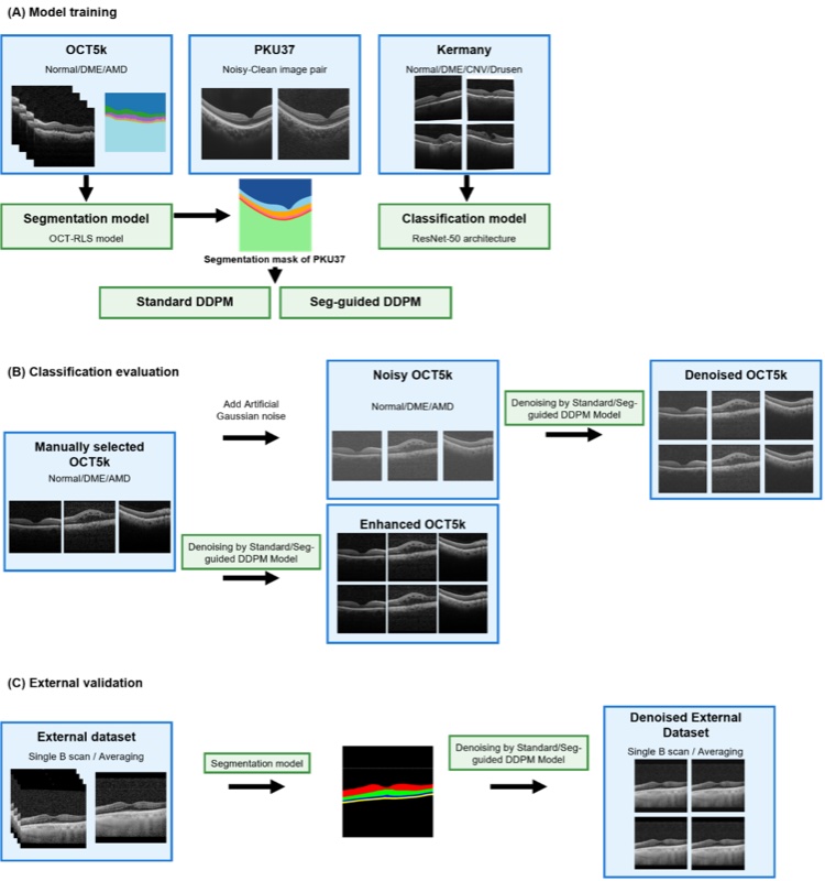 Segmentation-guided diffusion model for retinal OCT speckle reduction with anatomical structure preservation